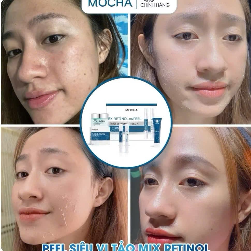 Retinol Mix Peel MOCHA 4in1 – Peel Da Tại Nhà Hỗ Trợ Tái Tạo Da, Mịn Da, Sáng Da (Combo 4 Món)