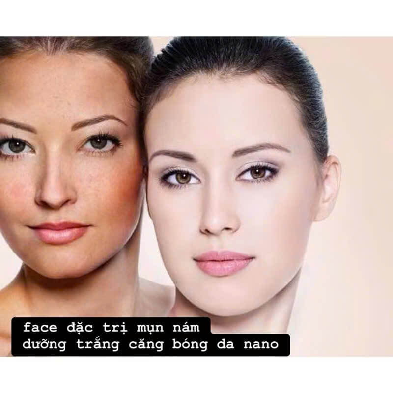Mờ nám tàn nhang mụn  mờ nám tàn nhang chống lão hoá phục hồi da giảm nếp nhăn dưỡng trắng da